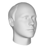 Balding_0